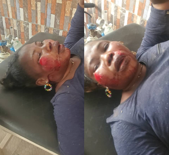Woman hospitalised after being brutalised by ex-husband for putting marks on their children (video)