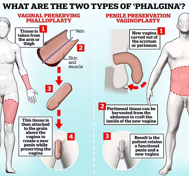 Non-binary people getting "phalgina" surgery to give them both male and female sex organs