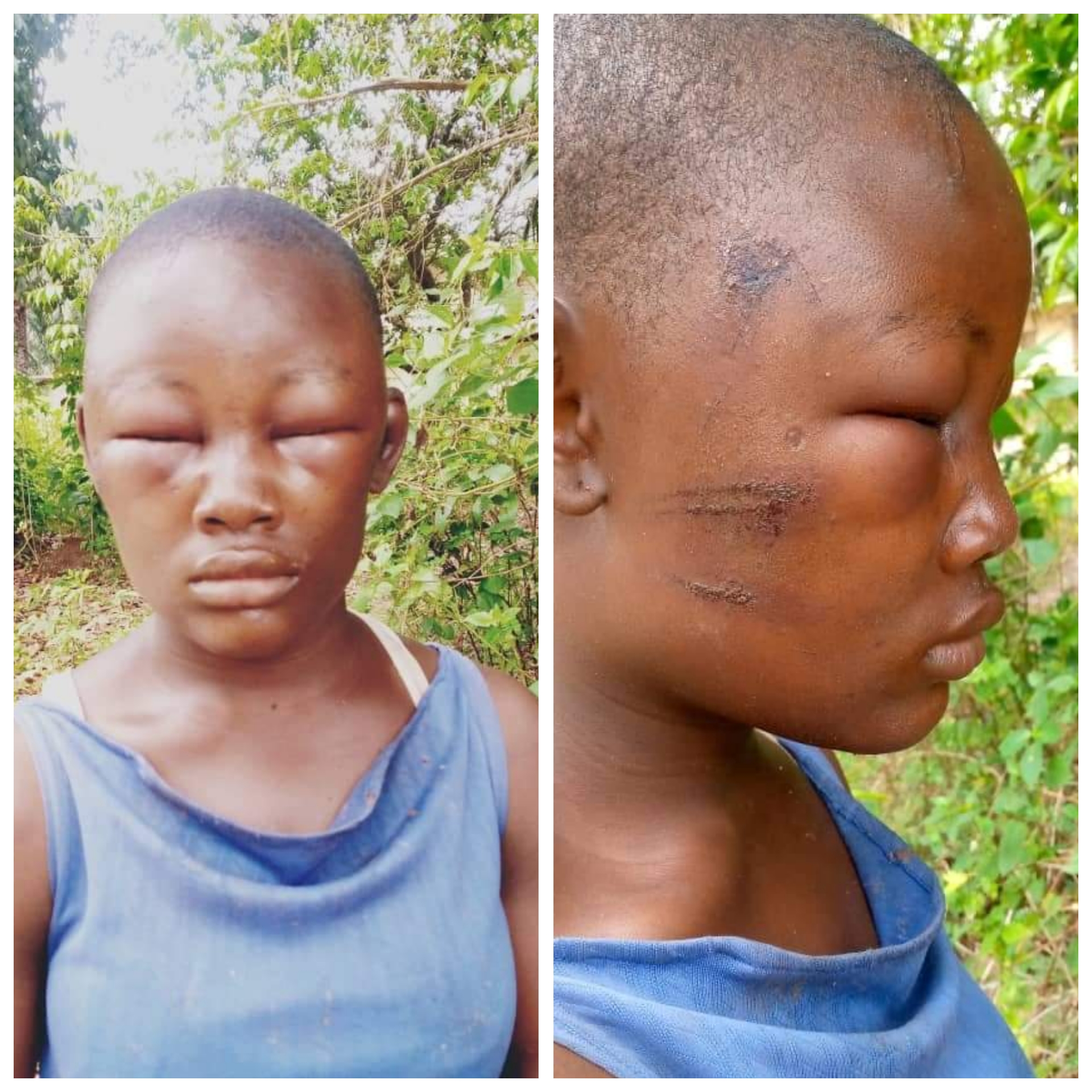 Woman brutalizes her 19-year-old maid in Anambra