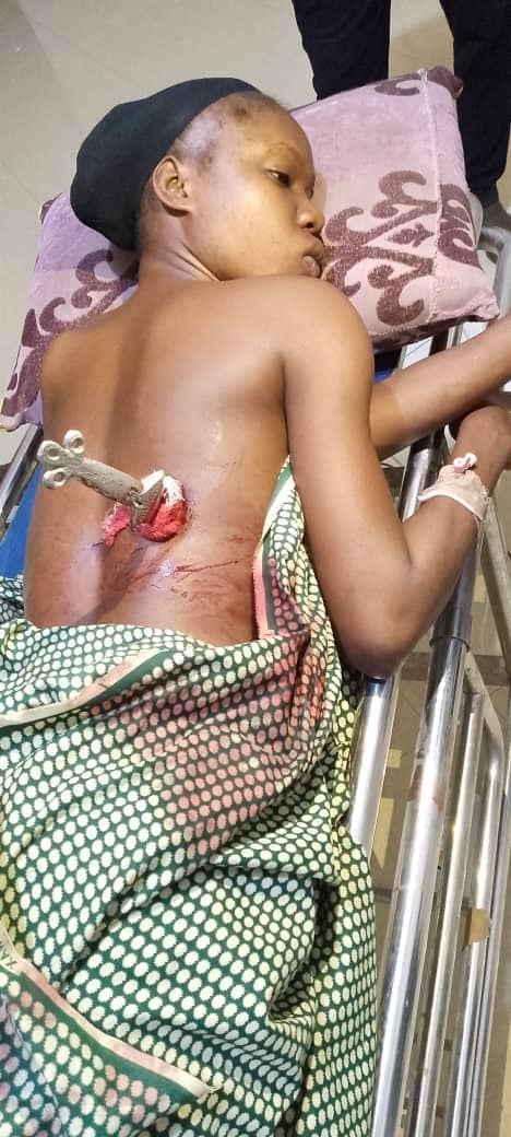 Police arrest phone snatcher who stabbed 24-year-old lady in Yobe